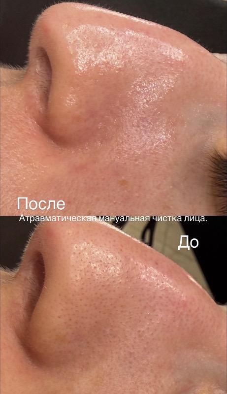 קוסמטיקה (ללא הזרקות) בת ים - Svetlana Cosmetology Bat Yam