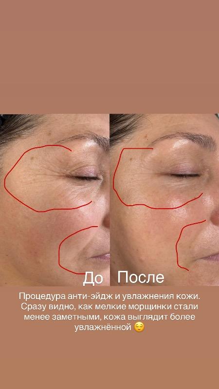 רפואה אסתטית / הזרקות בת ים - Svetlana Cosmetology Bat Yam