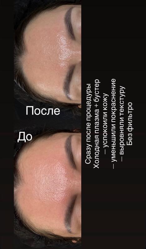 קוסמטיקה (ללא הזרקות) בת ים - Svetlana Cosmetology Bat Yam