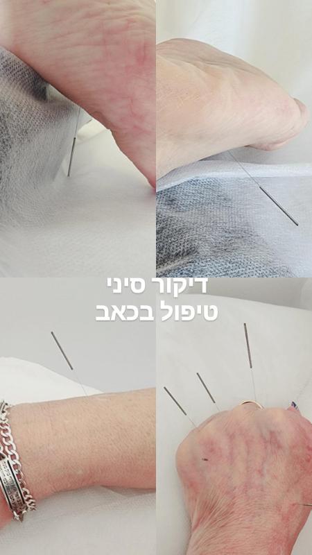 וולנס / בריאות חיפה - Ella Levi