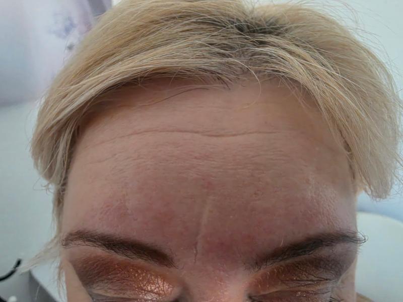 רפואה אסתטית / הזרקות חיפה - Beauty in health