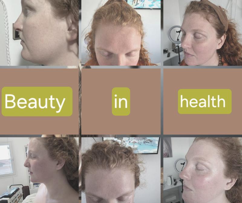רפואה אסתטית / הזרקות חיפה - Beauty in health