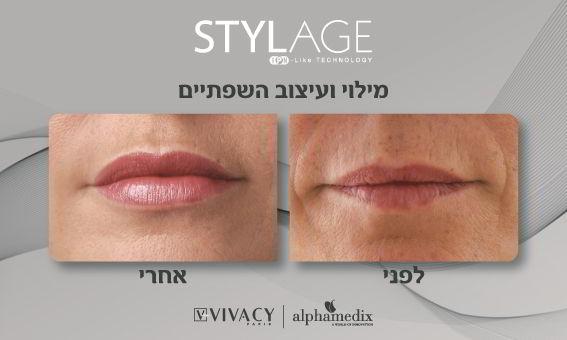 רפואה אסתטית / הזרקות קריית ביאליק - Dr Beauty ד"ר ביוטי מכון יופי