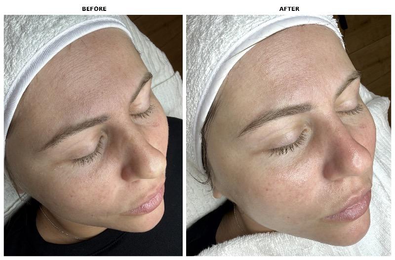 רפואה אסתטית / הזרקות נתניה - LUMI SKIN LAB