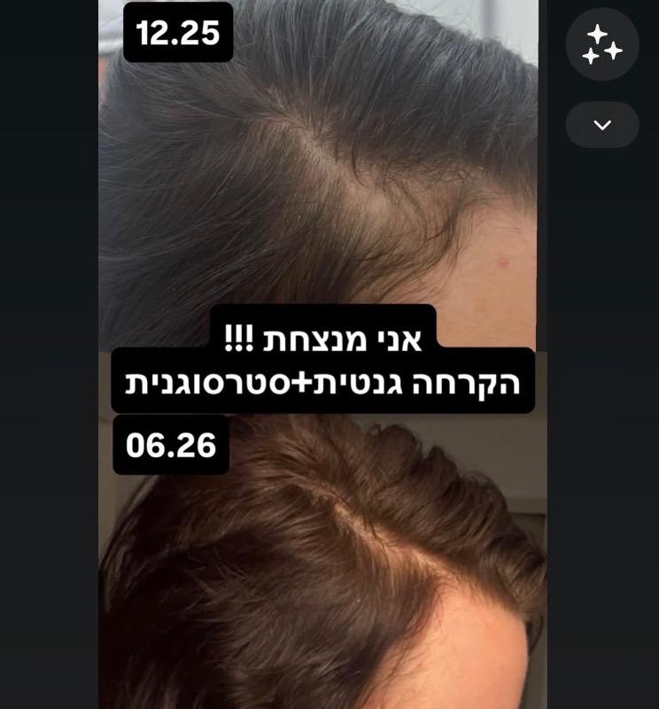 מעצבי שיער רחובות - ד״ר דניאלה סער