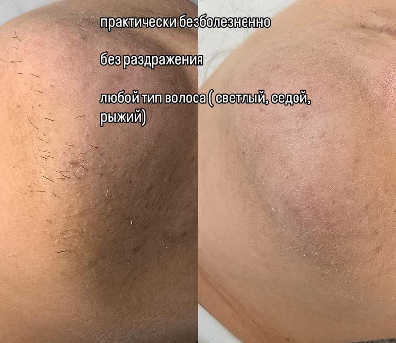 מעצבי שיער ראשון לציון - ILona_FaceFormula