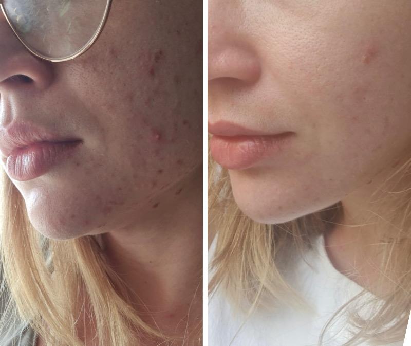 קוסמטיקה (ללא הזרקות) ראשון לציון - Evgenia Cosmetologist
