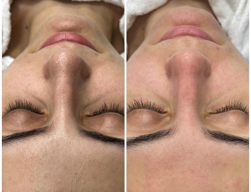 קוסמטיקה (ללא הזרקות) ראשון לציון - Evgenia Cosmetologist