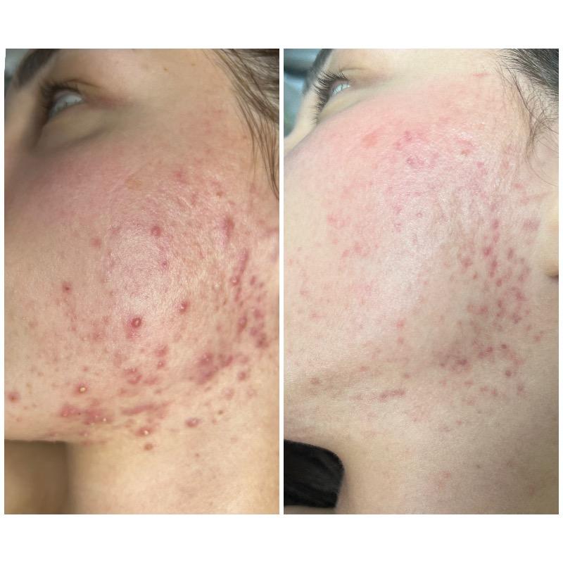 קוסמטיקה (ללא הזרקות) ראשון לציון - Evgenia Cosmetologist
