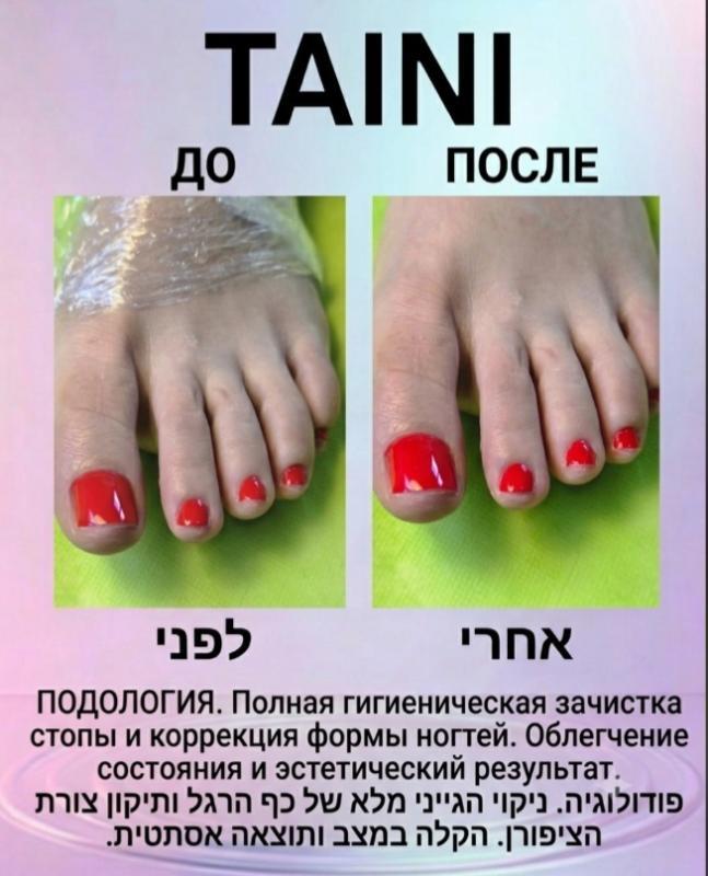 פודולוגיה פתח תקווה - Tatiana. TAINI