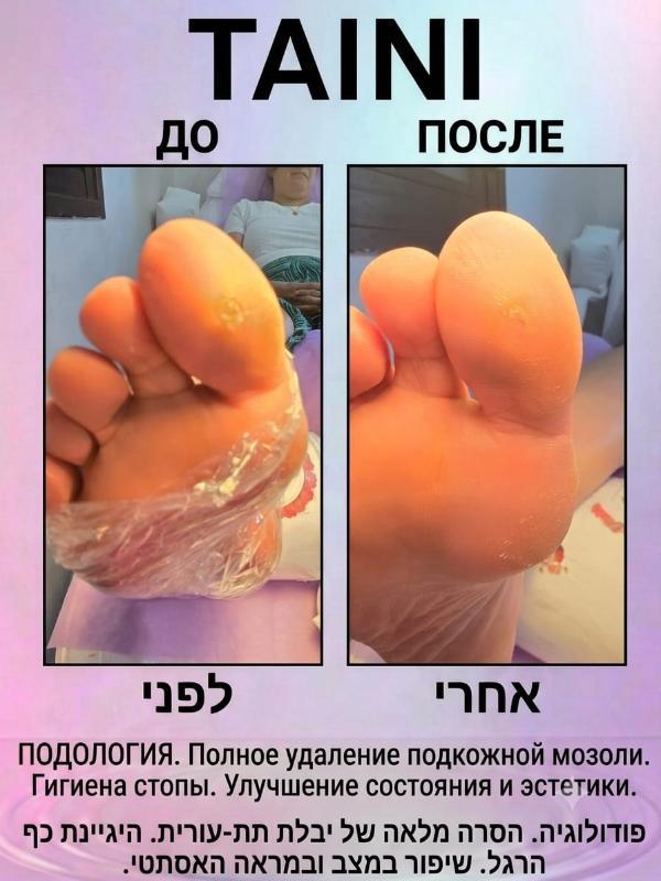 פודולוגיה פתח תקווה - Tatiana. TAINI