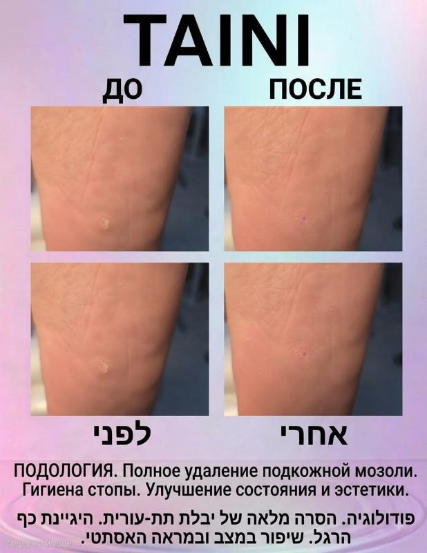 פודולוגיה פתח תקווה - Tatiana. TAINI