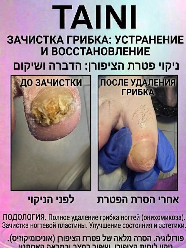 פודולוגיה פתח תקווה - Tatiana. TAINI