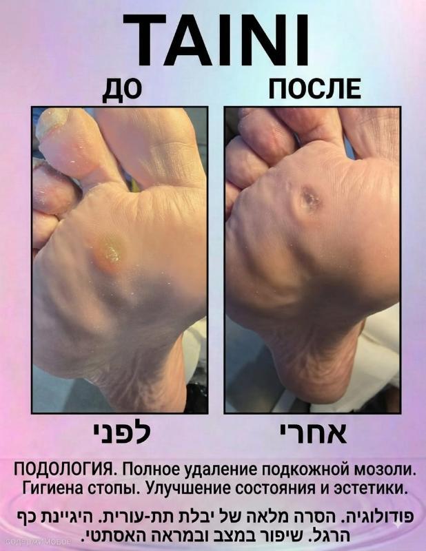 פודולוגיה פתח תקווה - Tatiana. TAINI
