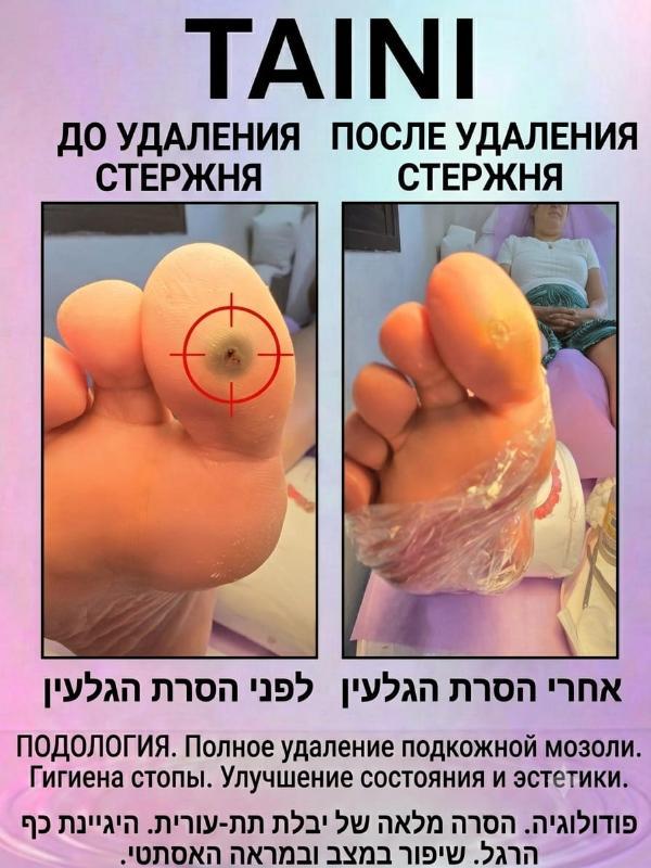 פודולוגיה פתח תקווה - Tatiana. TAINI
