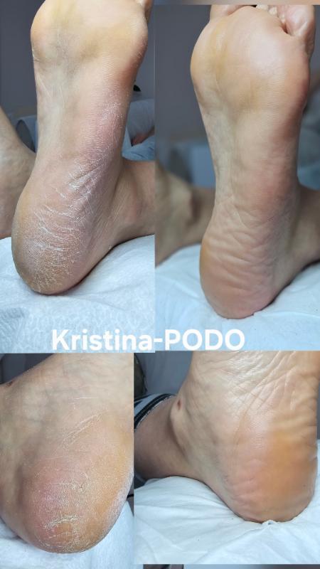 פודולוגיה ראשון לציון - Kristina-PODP