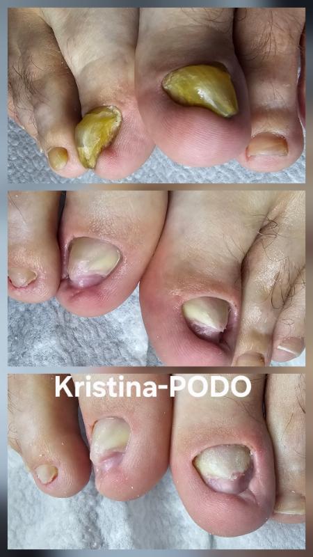 פודולוגיה ראשון לציון - Kristina-PODP