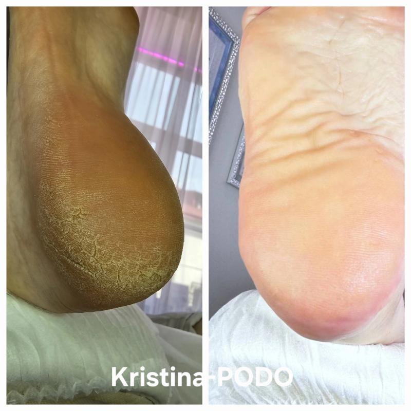 פודולוגיה ראשון לציון - Kristina-PODP