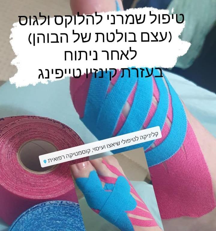 רפואה אסתטית / הזרקות אשקלון - NatashaClinic.il