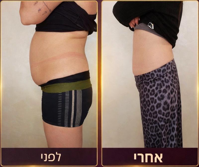 טיפוח הגוף ראשון לציון - LB BEAUTY