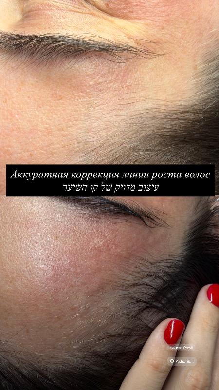 הסרת שיער אשקלון - מריה אפלרויט
