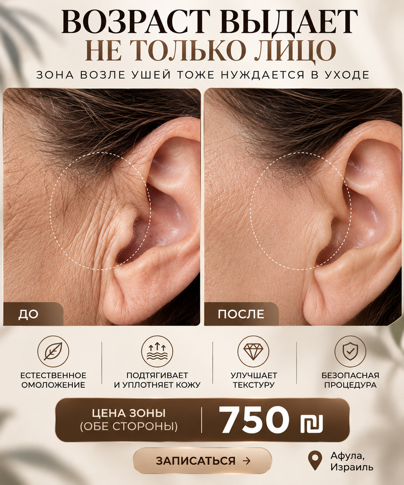 הסרת שיער עפולה - Инна