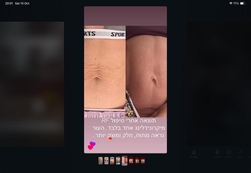 קוסמטיקה (ללא הזרקות) חיפה - SofiMed