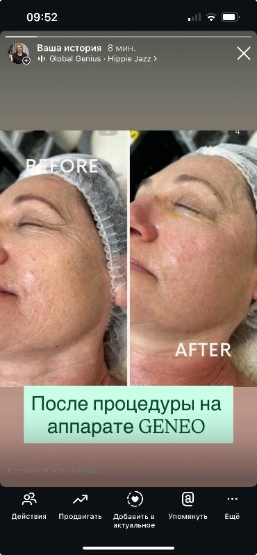 לייזר וטיפולים מכשירניים חיפה - Nature Skin Haifa Lusia Kaz