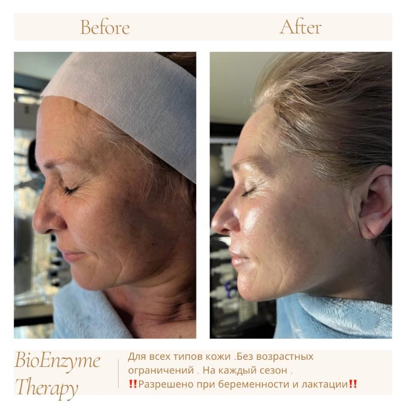 קוסמטיקה (ללא הזרקות) אשדוד - Yana Mashkin/Private Aesthetic Skin Expert