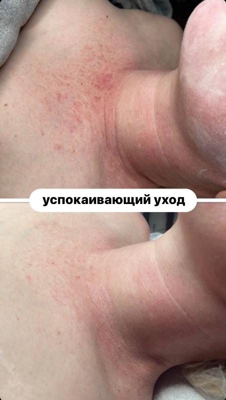 קוסמטיקה (ללא הזרקות) ראשון לציון - Veronika.skin.aesthetics