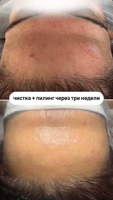 קוסמטיקה (ללא הזרקות) ראשון לציון - Veronika.skin.aesthetics
