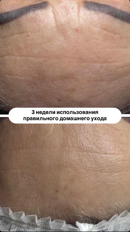 קוסמטיקה (ללא הזרקות) ראשון לציון - Veronika.skin.aesthetics