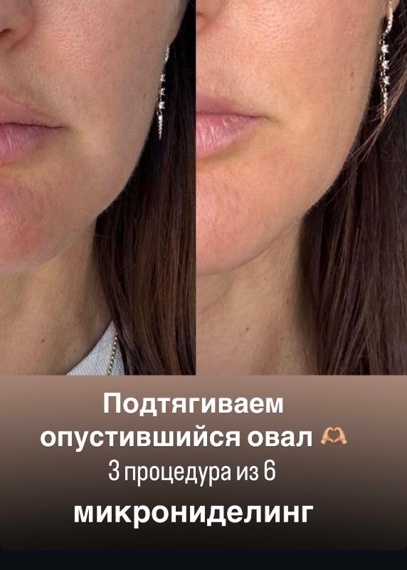 קוסמטיקה (ללא הזרקות) ראשון לציון - Veronika.skin.aesthetics