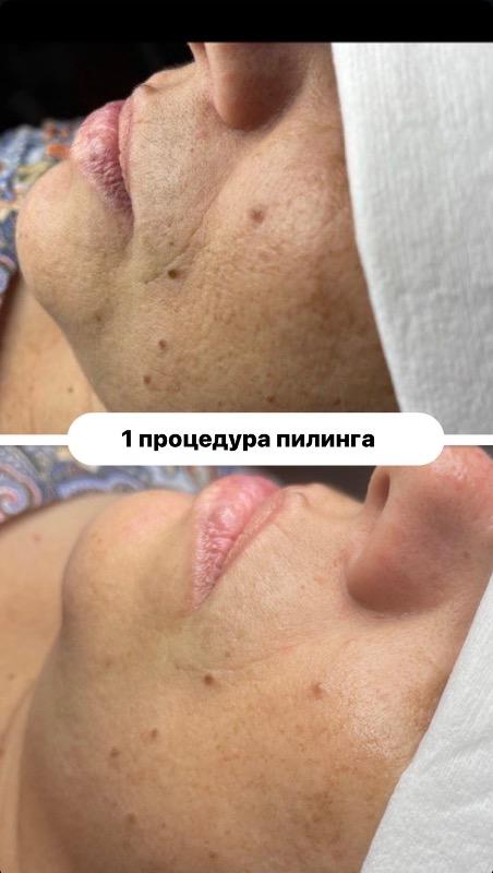 קוסמטיקה (ללא הזרקות) ראשון לציון - Veronika.skin.aesthetics