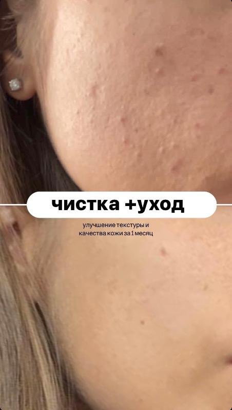 קוסמטיקה (ללא הזרקות) ראשון לציון - Veronika.skin.aesthetics
