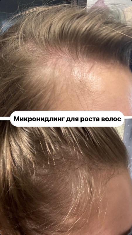 מעצבי שיער ראשון לציון - Veronika.skin.aesthetics